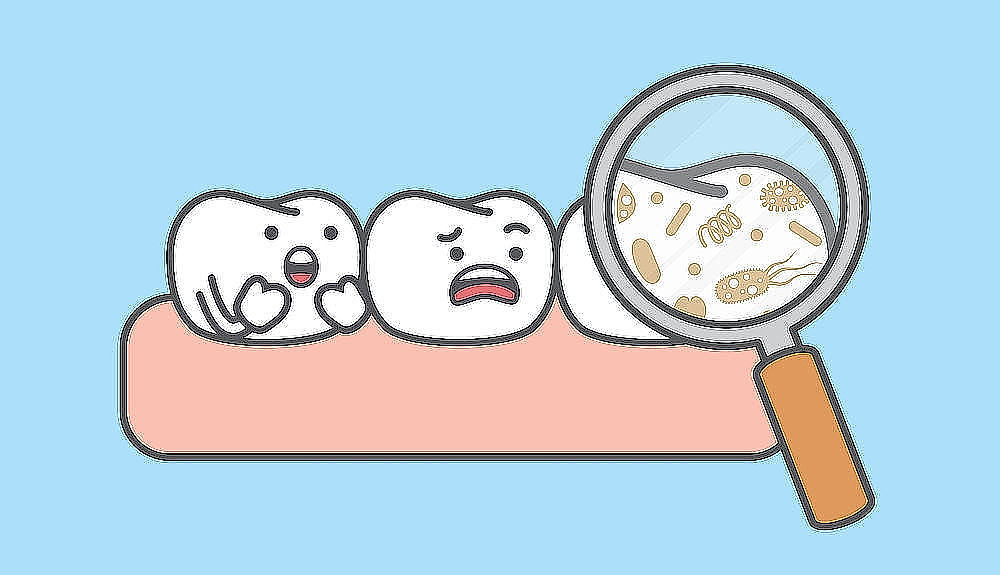 obrázek 1 k článku Zubní kaz: co to je a jak mu předcházet (snadné čtení)