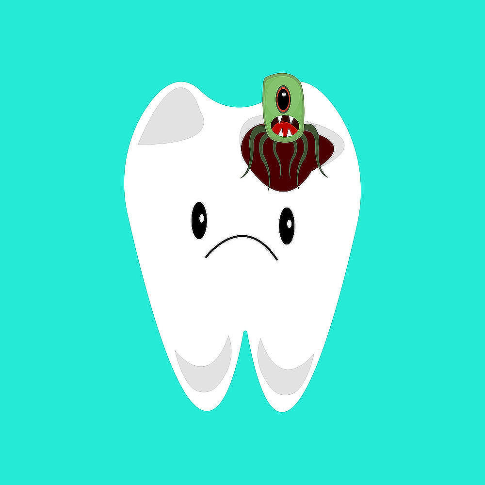 obrázek 2 k článku Zubní kaz: co to je a jak mu předcházet (snadné čtení)